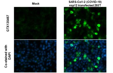 Anti-SARS-CoV-2 (COVID-19) nsp12 antibody used in Immunocytochemistry/ Immunofluorescence (ICC/IF). GTX135467