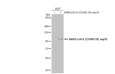 Anti-SARS-CoV-2 (COVID-19) nsp12 antibody used in Western Blot (WB). GTX135467
