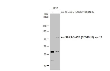 Anti-SARS-CoV-2 (COVID-19) nsp12 antibody used in Western Blot (WB). GTX135467