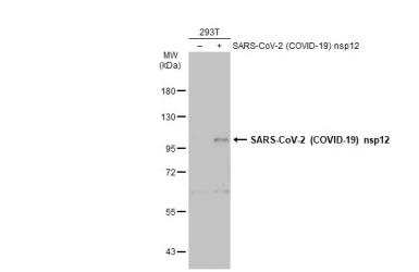 Anti-SARS-CoV-2 (COVID-19) nsp12 antibody used in Western Blot (WB). GTX135469