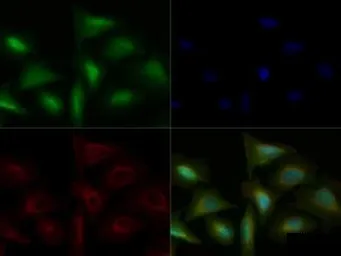 Anti-TLR4 antibody used in Immunocytochemistry/ Immunofluorescence (ICC/IF). GTX13556