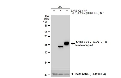 Anti-SARS-CoV-2 (COVID-19) Nucleocapsid antibody used in Western Blot (WB). GTX135570