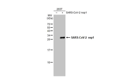 Anti-SARS-CoV-2 (COVID-19) nsp1 antibody used in Western Blot (WB). GTX135586