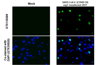 Anti-SARS-CoV-2 (COVID-19) nsp3 antibody used in IHC-P (cell pellet) (IHC-P (cell pellet)). GTX135589