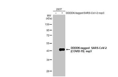Anti-SARS-CoV-2 (COVID-19) nsp3 antibody used in Western Blot (WB). GTX135589