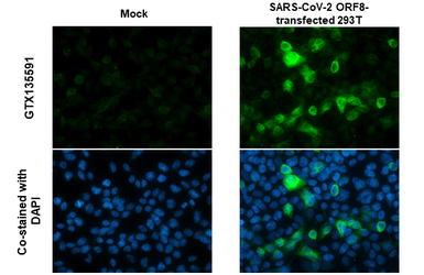 Anti-SARS-CoV-2 (COVID-19) ORF8 antibody used in Immunocytochemistry/ Immunofluorescence (ICC/IF). GTX135591