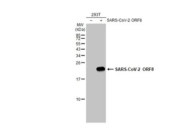Anti-SARS-CoV-2 (COVID-19) ORF8 antibody used in Western Blot (WB). GTX135591