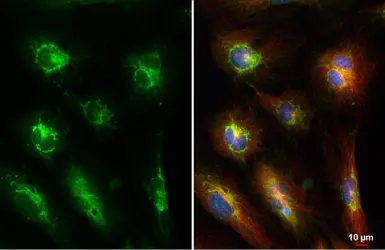 Anti-Pentraxin 3 antibody used in Immunocytochemistry/ Immunofluorescence (ICC/IF). GTX135596