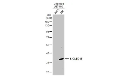 Anti-SIGLEC15 antibody used in Western Blot (WB). GTX135600
