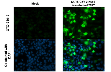 Anti-SARS-CoV-2 (COVID-19) nsp1 antibody used in Immunocytochemistry/ Immunofluorescence (ICC/IF). GTX135612