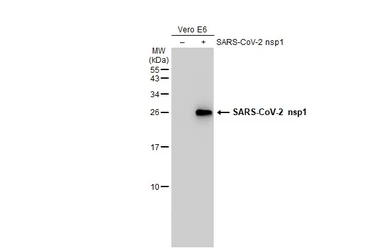 Anti-SARS-CoV-2 (COVID-19) nsp1 antibody used in Western Blot (WB). GTX135612