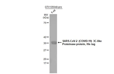 SARS-CoV-2 (COVID-19) 3CLpro (nsp5) protein, His tag. GTX135648-pro