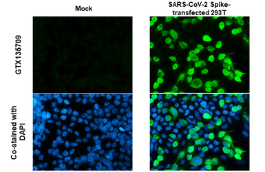Anti-SARS-CoV-2 (COVID-19) Spike RBD antibody used in Immunocytochemistry/ Immunofluorescence (ICC/IF). GTX135709