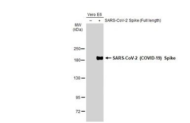 Anti-SARS-CoV-2 (COVID-19) Spike RBD antibody used in Western Blot (WB). GTX135709