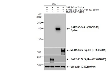 Anti-SARS-CoV-2 (COVID-19) Spike RBD antibody used in Western Blot (WB). GTX135709