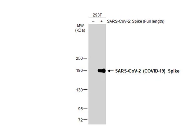 Anti-SARS-CoV-2 (COVID-19) Spike RBD antibody used in Western Blot (WB). GTX135709