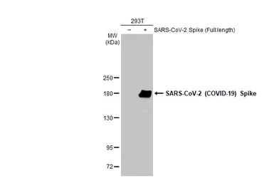 Anti-SARS-CoV-2 (COVID-19) Spike RBD antibody used in Western Blot (WB). GTX135709