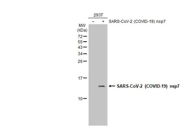 Anti-SARS-CoV-2 (COVID-19) nsp7 antibody used in Western Blot (WB). GTX135728