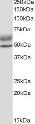 Anti-AIRE (isoforms 1 and 2) antibody, C-term used in Western Blot (WB). GTX13573