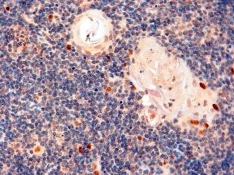 Anti-AIRE (isoforms 1 and 2) antibody, C-term used in IHC (Paraffin sections) (IHC-P). GTX13573