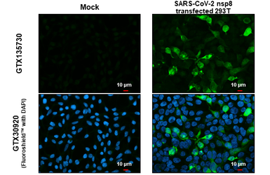 Anti-SARS-CoV-2 (COVID-19) nsp8 antibody used in Immunocytochemistry/ Immunofluorescence (ICC/IF). GTX135730