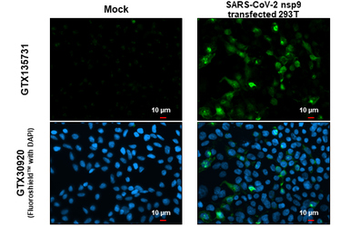 Anti-SARS-CoV-2 (COVID-19) nsp9 antibody used in Immunocytochemistry/ Immunofluorescence (ICC/IF). GTX135731