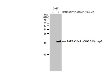 Anti-SARS-CoV-2 (COVID-19) nsp9 antibody used in Western Blot (WB). GTX135732