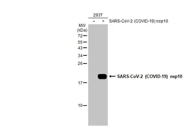 Anti-SARS-CoV-2 (COVID-19) nsp10 antibody used in Western Blot (WB). GTX135733