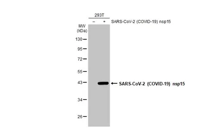 Anti-SARS-CoV-2 (COVID-19) nsp15 antibody used in Western Blot (WB). GTX135737