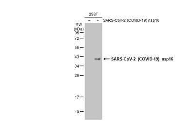 Anti-SARS-CoV-2 (COVID-19) nsp16 antibody used in Western Blot (WB). GTX135739