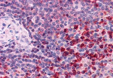 Anti-TrxR1 antibody, C-term used in IHC (Paraffin sections) (IHC-P). GTX13574