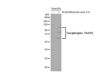 Anti-Tau (phospho Thr217) antibody used in Western Blot (WB). GTX135775