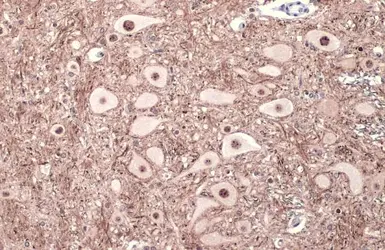Anti-Tau (phospho Thr181) antibody used in IHC (Paraffin sections) (IHC-P). GTX135776