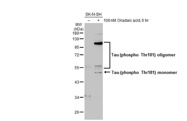 Anti-Tau (phospho Thr181) antibody used in Western Blot (WB). GTX135776
