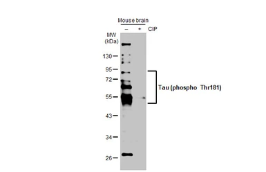 Anti-Tau (phospho Thr181) antibody used in Western Blot (WB). GTX135776