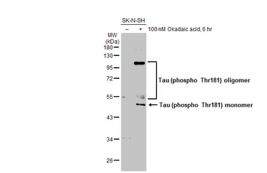 Anti-Tau (phospho Thr181) antibody used in Western Blot (WB). GTX135776