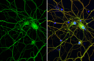 Anti-Tau (phospho Thr181) antibody used in Immunocytochemistry/ Immunofluorescence (ICC/IF). GTX135776