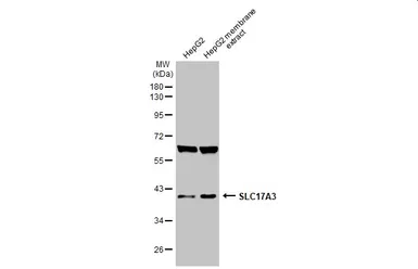 Anti-SLC17A3 antibody used in Western Blot (WB). GTX135781