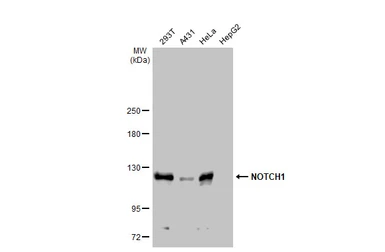 Anti-NOTCH1 antibody used in Western Blot (WB). GTX135786