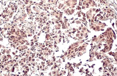 Anti-NOTCH1 antibody used in IHC (Paraffin sections) (IHC-P). GTX135786