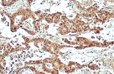 Anti-NOTCH1 antibody used in IHC (Paraffin sections) (IHC-P). GTX135786