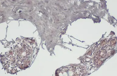 Anti-NOTCH1 antibody used in IHC (Paraffin sections) (IHC-P). GTX135786