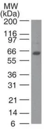 Anti-TRF2 antibody [4A794.15] used in Western Blot (WB). GTX13579