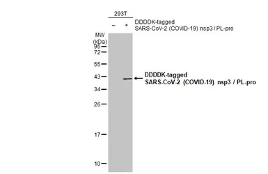 Anti-SARS-CoV-2 (COVID-19) nsp3 / PL-pro antibody used in Western Blot (WB). GTX135796