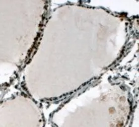 Anti-ELF5 antibody, C-term used in IHC (Paraffin sections) (IHC-P). GTX13581