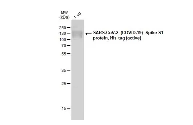SARS-CoV-2 (COVID-19) Spike S1 protein, His tag (active). GTX135817-pro