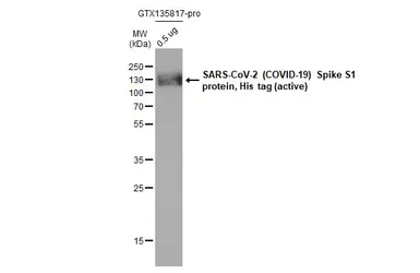SARS-CoV-2 (COVID-19) Spike S1 protein, His tag (active). GTX135817-pro