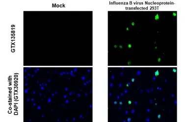 Anti-Influenza B virus Nucleoprotein antibody used in IHC-P (cell pellet) (IHC-P (cell pellet)). GTX135819