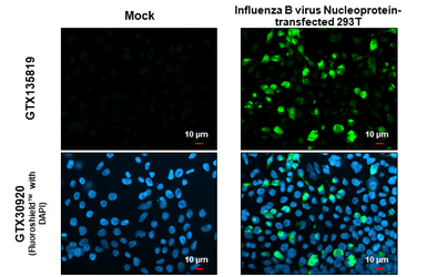 Anti-Influenza B virus Nucleoprotein antibody used in Immunocytochemistry/ Immunofluorescence (ICC/IF). GTX135819