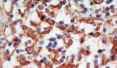Anti-sRANKL antibody [12A668] used in IHC (Paraffin sections) (IHC-P). GTX13582